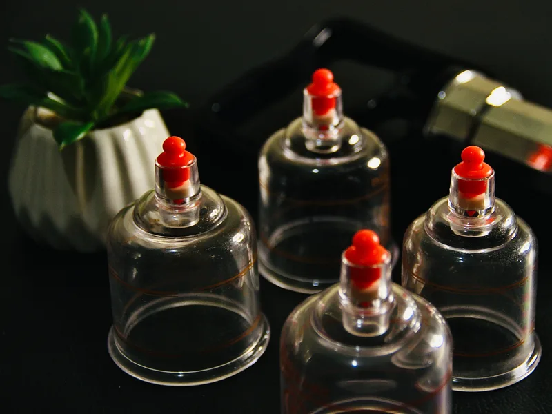 How Cupping Therapy works at Sarasota Auto Injury Clinic