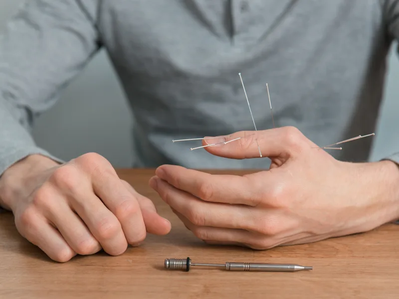 Dry Needling at Sarasota Auto Injury Clinic in Sarasota