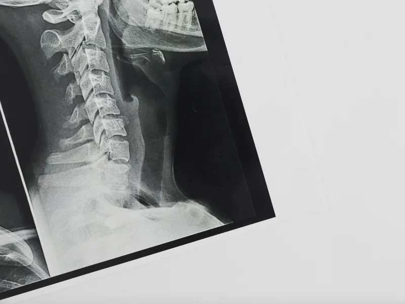 X-Rays at Sarasota Auto Injury Clinic in Sarasota