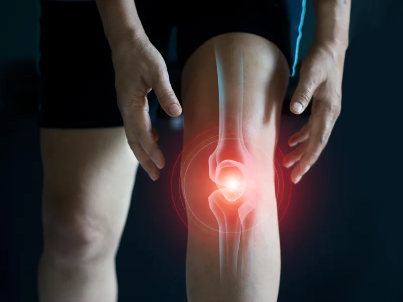 How Sarasota Auto Injury Clinic treats arthritis in Sarasota